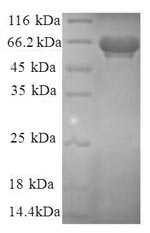 Recombinant Human Eukaryotic translation initiation factor 3 subunit F (EIF3F), partial