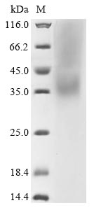 Recombinant Human coronavirus HKU1 Spike glycoprotein (S), partial