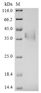 Recombinant Bovine coronavirus Spike glycoprotein (S), partial