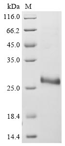 Recombinant Bovine coronavirus Protein I (N)