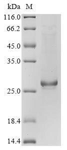 Recombinant Bovine coronavirus Protein I (N)