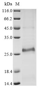 Recombinant Bovine coronavirus Protein I (N)