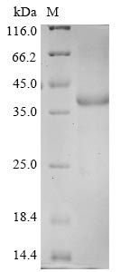 Recombinant Human coronavirus HKU1 Spike glycoprotein (S), partial