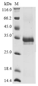 Recombinant Human coronavirus HKU1 Spike glycoprotein (S), partial