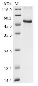 Recombinant Human coronavirus HKU1 Nucleoprotein (N)