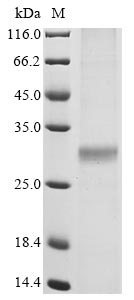 Recombinant Severe acute respiratory syndrome coronavirus Replicase 1AB polyprotein, partial