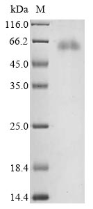 Recombinant Bovine coronavirus Nucleoprotein (N)