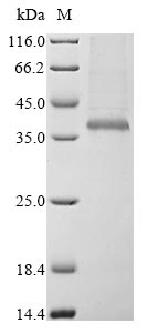 Recombinant Bovine coronavirus Spike glycoprotein (S), partial