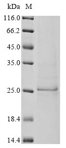 Recombinant Bat coronavirus HKU3 Spike glycoprotein (S), partial