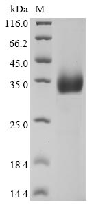 Recombinant Bovine coronavirus Spike glycoprotein (S), partial