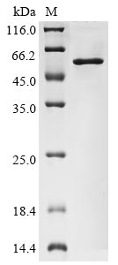 Recombinant Human coronavirus HKU1 Nucleoprotein (N)