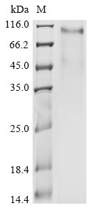 Recombinant Human coronavirus HKU1 Spike glycoprotein (S), partial