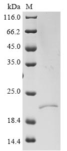 Recombinant Severe acute respiratory syndrome coronavirus 2 Envelope small membrane protein&Membrane protein (E&M), partial