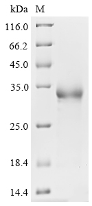 Recombinant Human Novel Coronavirus Spike glycoprotein(S)(K417N,E484K,N501Y),partial