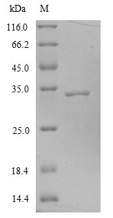 Recombinant Human Novel Coronavirus Spike glycoprotein(S) (E484K),partial