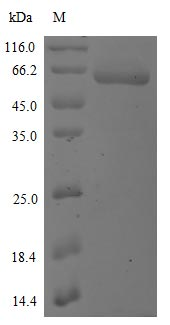 Recombinant Human Novel Coronavirus Spike glycoprotein(S) (K417N),partial