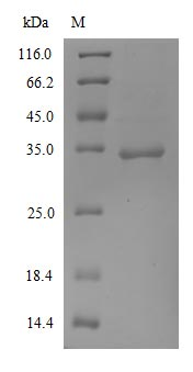 Recombinant Human Novel Coronavirus Spike glycoprotein(S) (K417N),partial