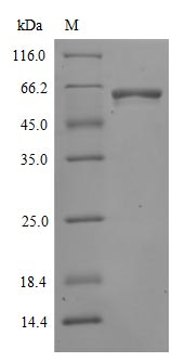 Recombinant Human Novel Coronavirus Spike glycoprotein(S) (N501Y),partial (Active)