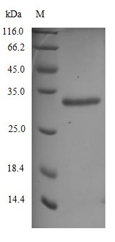 Recombinant Human Novel Coronavirus Spike glycoprotein(S) (N501Y),partial (Active)