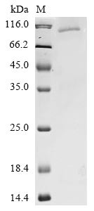 Recombinant Human Novel Coronavirus Spike glycoprotein(S)(N501Y,P681H),partial