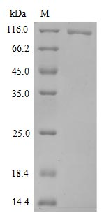 Recombinant Human Novel Coronavirus Spike glycoprotein(S)(N501Y,P681H),partial