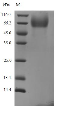 Recombinant Human Novel Coronavirus Spike glycoprotein(S), partial