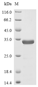 Recombinant Human Novel Coronavirus Nucleoprotein(N),partial