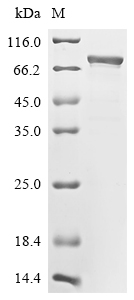 Recombinant Human Novel Coronavirus Nucleoprotein(N),partial,Biotinylated