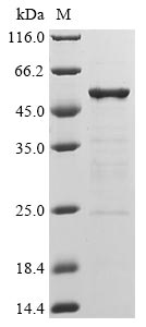 Recombinant Human Novel Coronavirus Nucleoprotein(N)(Q384H) (Active)