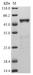 Recombinant Human Novel Coronavirus Nucleoprotein(N)(L230F) (Active)