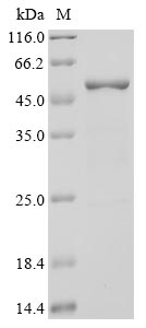 Recombinant Human Novel Coronavirus Nucleoprotein(N)(P13L) (Active)