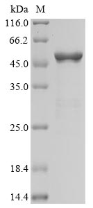 Recombinant Human Novel Coronavirus Nucleoprotein(N)(T205I) (Active)