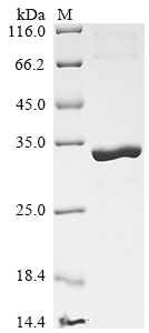 Bothrops jararaca Thrombin-like enzyme bothrombin Protein