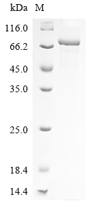Severe acute respiratory syndrome coronavirus 2 Spike glycoprotein Protein
