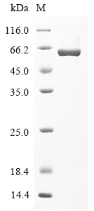 Rat Glucose-6-phosphate isomerase Protein