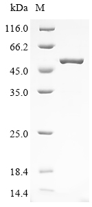 Severe acute respiratory syndrome coronavirus 2 Nucleoprotein Protein