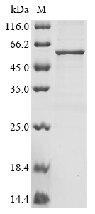 Severe acute respiratory syndrome coronavirus 2 Nucleoprotein Protein