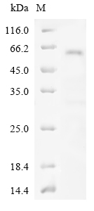 Human PDGFRB Protein