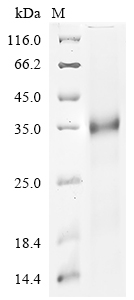 Severe acute respiratory syndrome coronavirus 2 Spike glycoprotein Protein