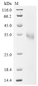 Severe acute respiratory syndrome coronavirus 2 Spike glycoprotein Protein