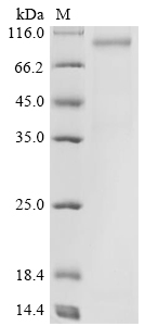 Severe acute respiratory syndrome coronavirus 2 Spike glycoprotein Protein