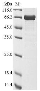 Bat coronavirus HKU9 Nucleoprotein Protein