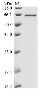 Bat coronavirus HKU9 Nucleoprotein Protein