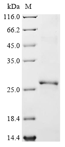 Human HPRT1 Protein