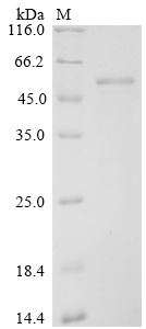 Severe acute respiratory syndrome coronavirus 2 Nucleoprotein Protein