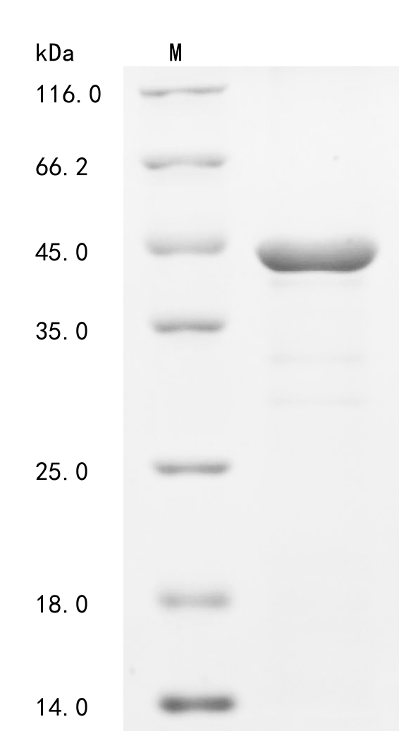 Human SDCBP Protein