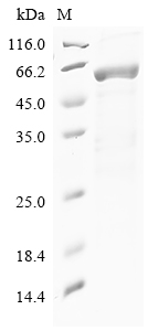Human SDCBP Protein