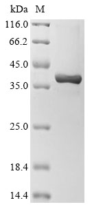Mouse Tyk2 Protein