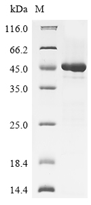 Human IL17F Protein