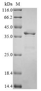 Human MS4A1 Protein